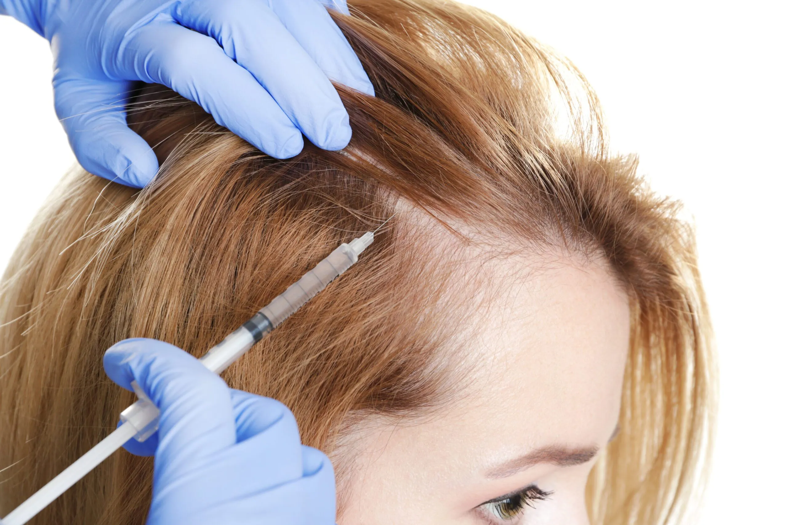 Hair loss treatments in Izmir