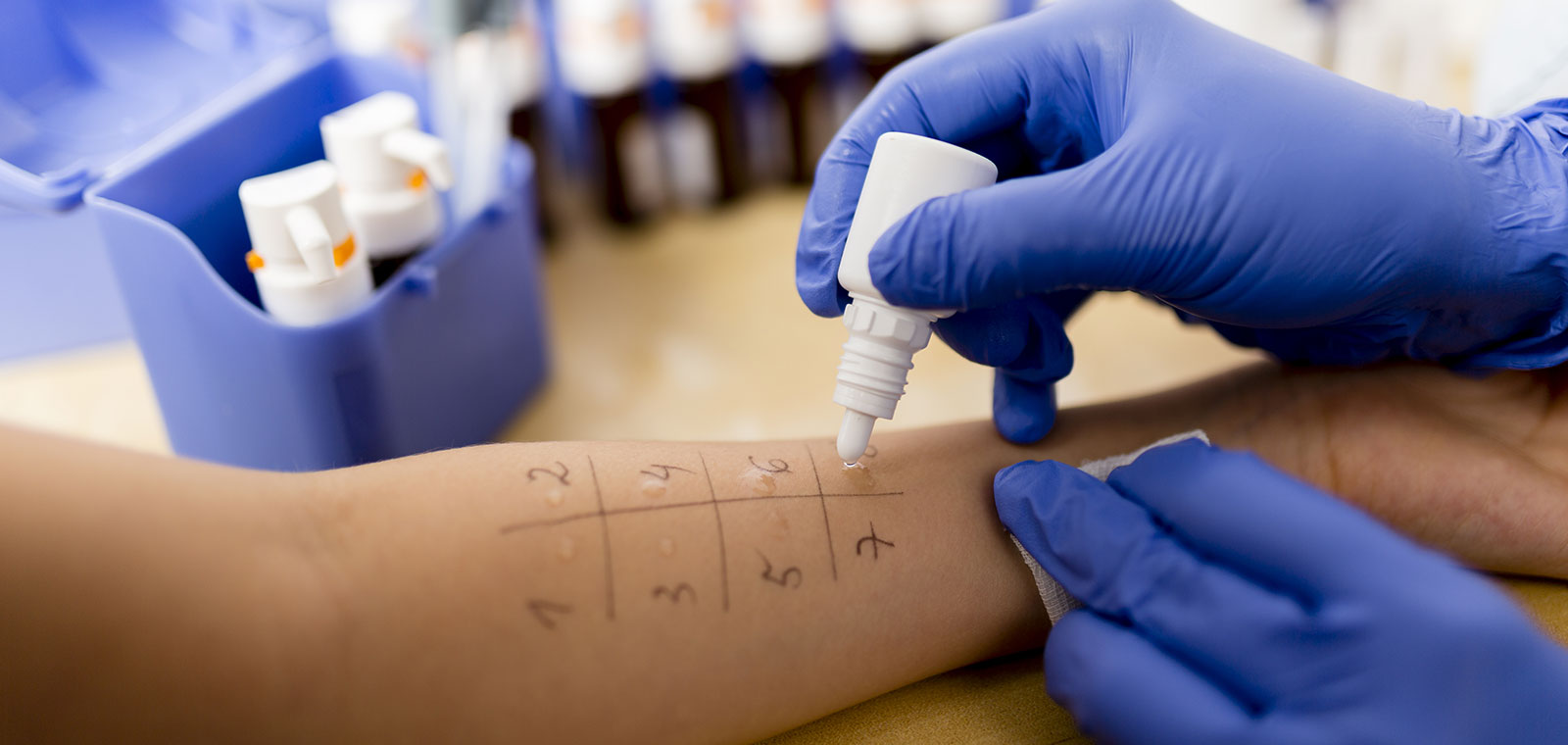 alerji testi izmir dr sedef demirer İzmir Alsancak’ta Dermatolog Dr. Sedef Demirer tarafından yapılan alerji testi ve bilmeniz gereken bilgiler