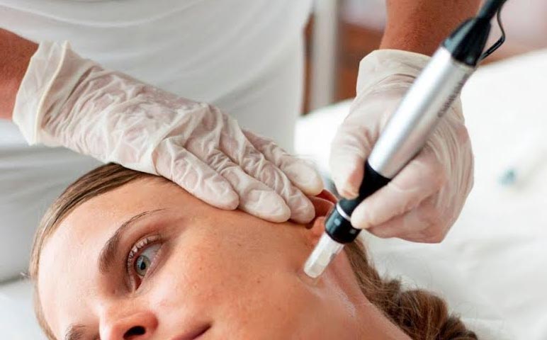 Dermapen mikroiğneleme tedavisi İzmir Alsancak’ta Dermatolog Dr. Sedef Demirer tarafından uygulanmaktadır