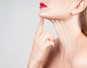 hifu nedir ameliyatsiz yuz germe HIFU (High Intensity Focused Ultrasound) nedir? Cilt altı odaklı ultrasonla ameliyatsız yüz germe ve kolajen artırma – İzmir Dermatolog Dr. Sedef Demirer