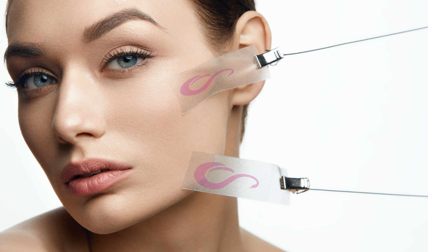 İzmir Alsancak’ta Dermatolog Dr. Sedef Demirer tarafından uygulanan iple yüz germe tedavisi ile ameliyatsız yüz gençleştirme